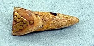 Inlaid Tooth by Unknown Artist
