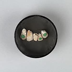 Human tooth inlaid with jadeite by Unknown Artist