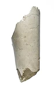 Arm, forearm by Unknown Artist