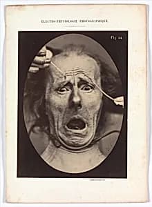 Electro–Physiologie, Figure 64 by Adrien Tournachon|Guillaume-Benjamin-Amand Duchenne de Boulogne