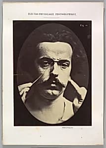 Figure 16: Expression of severity  by Guillaume-Benjamin-Amand Duchenne de Boulogne|Adrien Tournachon