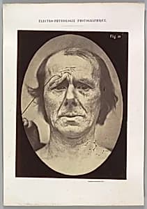 Figure 19: Suffering by Guillaume-Benjamin-Amand Duchenne de Boulogne|Adrien Tournachon