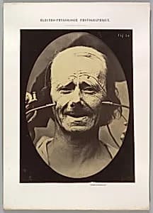 Portrait of Guillaume-Benjamin-Amand Duchenne de Boulogne|Adrien Tournachon