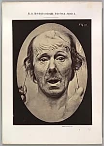 Figure 56: Surprise