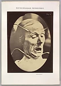 Figure 62: Terror, semiprofile by Guillaume-Benjamin-Amand Duchenne de Boulogne|Adrien Tournachon