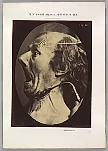 Figure 63: Expression of terror by Guillaume-Benjamin-Amand Duchenne de Boulogne|Adrien Tournachon