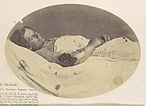 Frederick Pilgrim