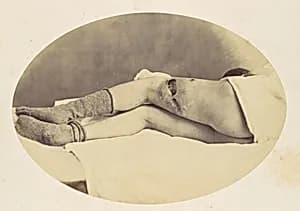 Judson C. Albright by Reed Brockway Bontecou