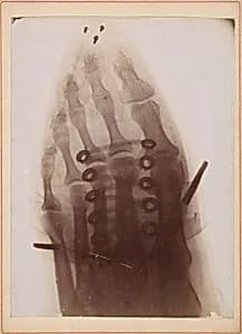 Le pied à travers la chaussure by Dr. Henri van Heurck