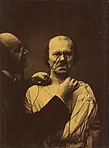 Aggression, wickedness by Guillaume-Benjamin-Amant Duchenne (de Boulogne)