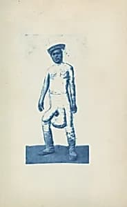 Elephantiasis by Unknown 19th Century