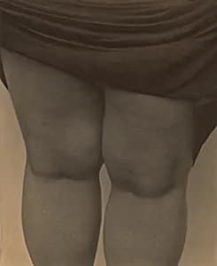 Legs, Lake George by Alfred Stieglitz