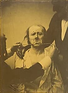 Pain and despair by Guillaume-Benjamin-Amant Duchenne (de Boulogne), French, 1806 - 1875, and Adrien Tournachon, French, 1825 - 1903