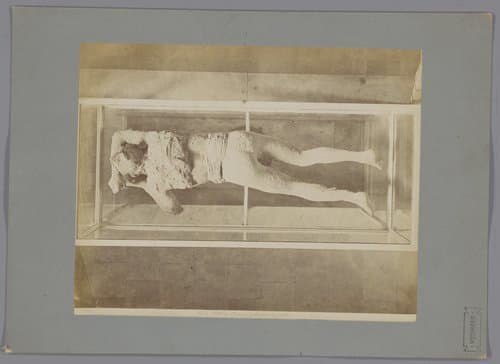 (Museo) Cadavere di donna by Giacomo Brogi